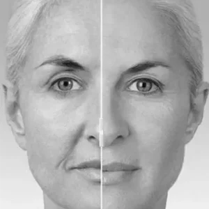 Maderoterapia facial con mascarilla C y alginato